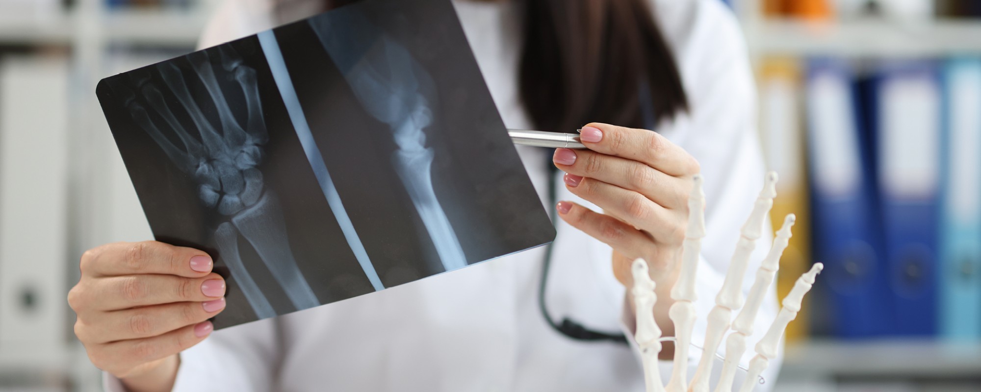 Zdravljenje pri osteoporozi v2